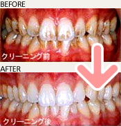 プロフェッショナルクリーニング